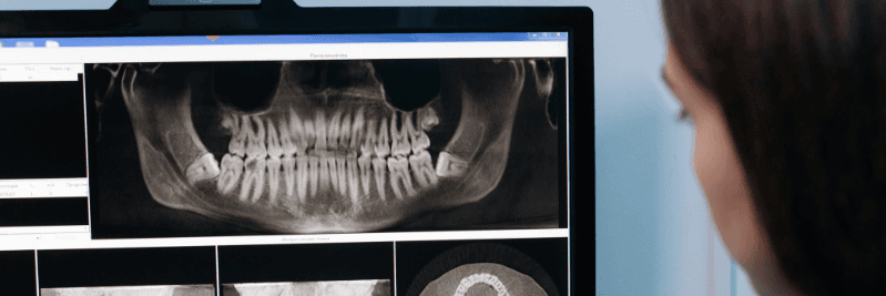 dr mistry looking at x-rays at bayside smiles in black rock